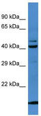 Serpin Family B Member 8 antibody, TA344595, Origene, Western Blot image 