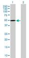 Mannan Binding Lectin Serine Peptidase 1 antibody, H00005648-D01P, Novus Biologicals, Western Blot image 