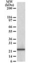 RAN, Member RAS Oncogene Family antibody, NB100-1442, Novus Biologicals, Western Blot image 