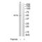 Interferon Induced Protein With Tetratricopeptide Repeats 5 antibody, A07415, Boster Biological Technology, Western Blot image 