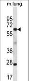 Sp2 Transcription Factor antibody, LS-C159067, Lifespan Biosciences, Western Blot image 