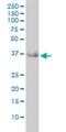 Glyoxylate And Hydroxypyruvate Reductase antibody, H00009380-M01, Novus Biologicals, Western Blot image 