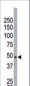 NIMA Related Kinase 2 antibody, LS-C101165, Lifespan Biosciences, Western Blot image 