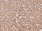 Peroxisomal Trans-2-Enoyl-CoA Reductase antibody, 204046-T08, Sino Biological, Immunohistochemistry paraffin image 