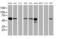 Farnesyl-Diphosphate Farnesyltransferase 1 antibody, MA5-25676, Invitrogen Antibodies, Western Blot image 