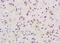 Cofilin 1 antibody, orb5891, Biorbyt, Immunohistochemistry paraffin image 