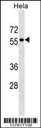 Adhesion Molecule With Ig Like Domain 3 antibody, 59-339, ProSci, Western Blot image 