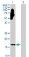 NME/NM23 Nucleoside Diphosphate Kinase 3 antibody, H00004832-D01P, Novus Biologicals, Western Blot image 