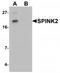 Serine Peptidase Inhibitor, Kazal Type 2 antibody, TA319708, Origene, Western Blot image 