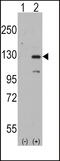 Disheveled-associated activator of morphogenesis 1 antibody, 61-449, ProSci, Western Blot image 