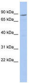 Ribosomal Protein S6 Kinase A2 antibody, TA335494, Origene, Western Blot image 