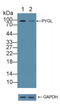 Glycogen Phosphorylase L antibody, LS-C294286, Lifespan Biosciences, Western Blot image 