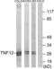 TNF Superfamily Member 12 antibody, LS-B7051, Lifespan Biosciences, Western Blot image 