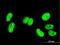 High Mobility Group Box 1 antibody, H00003146-M03, Novus Biologicals, Immunocytochemistry image 