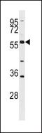 BLK Proto-Oncogene, Src Family Tyrosine Kinase antibody, PA5-14768, Invitrogen Antibodies, Western Blot image 