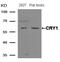 Cryptochrome Circadian Regulator 1 antibody, GTX50642, GeneTex, Western Blot image 