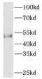 Syndapin 1 antibody, FNab06100, FineTest, Western Blot image 