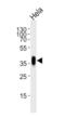Folate Receptor Alpha antibody, orb376052, Biorbyt, Western Blot image 