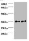 Secretory Carrier Membrane Protein 3 antibody, A54005-100, Epigentek, Western Blot image 