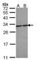 Tyrosine 3-Monooxygenase/Tryptophan 5-Monooxygenase Activation Protein Epsilon antibody, PA5-28937, Invitrogen Antibodies, Western Blot image 