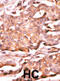 RAD9 Checkpoint Clamp Component A antibody, abx031900, Abbexa, Immunohistochemistry paraffin image 