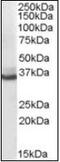 Aldo-Keto Reductase Family 1 Member C4 antibody, orb88441, Biorbyt, Western Blot image 