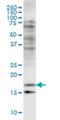 Cofilin 2 antibody, H00001073-M03, Novus Biologicals, Western Blot image 