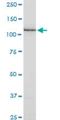 Slingshot Protein Phosphatase 1 antibody, H00054434-M02, Novus Biologicals, Western Blot image 