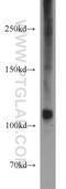 Protein Tyrosine Kinase 2 Beta antibody, 17592-1-AP, Proteintech Group, Western Blot image 