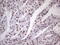 Nudix Hydrolase 21 antibody, M09247-1, Boster Biological Technology, Immunohistochemistry paraffin image 