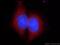 Terminal Uridylyl Transferase 4 antibody, 18980-1-AP, Proteintech Group, Immunofluorescence image 