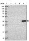 Hydroxysteroid 11-Beta Dehydrogenase 1 antibody, NBP2-48879, Novus Biologicals, Western Blot image 