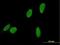 DSCC1 antibody, H00079075-B01P, Novus Biologicals, Immunocytochemistry image 