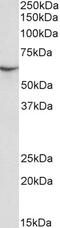 Apolipoprotein B MRNA Editing Enzyme Catalytic Subunit 3G antibody, 43-587, ProSci, Immunohistochemistry paraffin image 