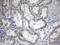 CD248 Molecule antibody, LS-C793991, Lifespan Biosciences, Immunohistochemistry paraffin image 