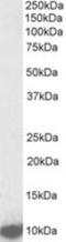 U6 snRNA-associated Sm-like protein LSm2 antibody, NBP2-26136, Novus Biologicals, Western Blot image 