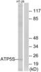 Distal Membrane Arm Assembly Complex 2 Like antibody, abx014225, Abbexa, Western Blot image 