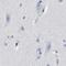 Meckel syndrome type 1 protein antibody, PA5-54515, Invitrogen Antibodies, Immunohistochemistry frozen image 