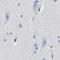 MKS Transition Zone Complex Subunit 1 antibody, PA5-54515, Invitrogen Antibodies, Immunohistochemistry frozen image 