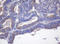 Cytochrome P450 2J2 antibody, LS-C173273, Lifespan Biosciences, Immunohistochemistry paraffin image 