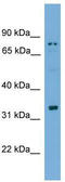 Sperm Acrosome Associated 1 antibody, TA339572, Origene, Western Blot image 