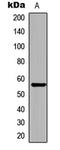 Checkpoint Kinase 1 antibody, LS-C358940, Lifespan Biosciences, Western Blot image 