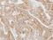 AP2M1 antibody, LS-C185408, Lifespan Biosciences, Immunohistochemistry paraffin image 