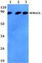 SEM3A antibody, A01761, Boster Biological Technology, Western Blot image 