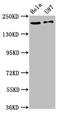 Sodium Voltage-Gated Channel Alpha Subunit 10 antibody, LS-C673682, Lifespan Biosciences, Western Blot image 