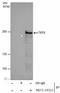 Tet Methylcytosine Dioxygenase 2 antibody, NBP2-43554, Novus Biologicals, Immunoprecipitation image 