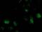 ATPase H+ Transporting V1 Subunit F antibody, MA5-25386, Invitrogen Antibodies, Immunocytochemistry image 