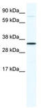 Homeobox protein MSX-1 antibody, TA342280, Origene, Western Blot image 