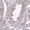Cold Shock Domain Containing E1 antibody, NBP2-38665, Novus Biologicals, Immunohistochemistry paraffin image 