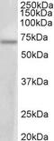 Protein Arginine Methyltransferase 3 antibody, TA311343, Origene, Western Blot image 